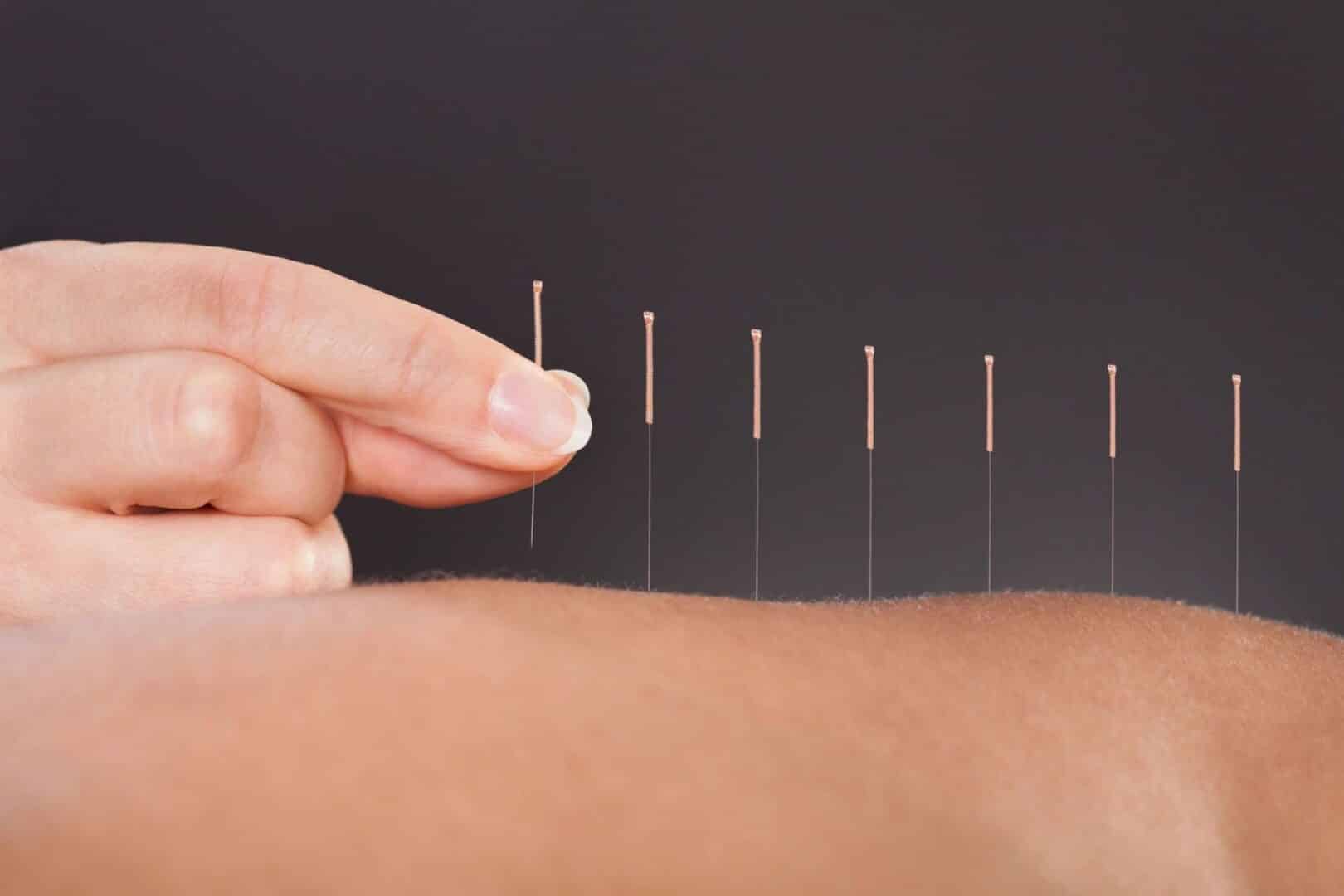 Whole Body Alignment - Chiropractic, Graston, Acupuncture